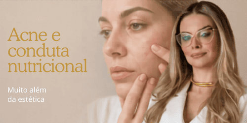 Acne e conduta nutricional